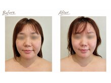 ビエンビエン(bien bien)/小顔フェイシャルリンパ 