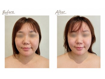 ビエンビエン(bien bien)/小顔フェイシャルリンパ 
