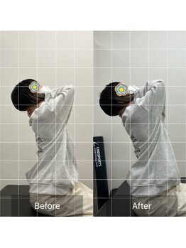 ナオル整体 相模大野院(NAORU整体)/施術事例【20代女性】