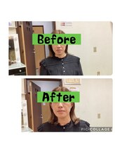 ソラ(SORA)/ゴッドハンドの小顔矯正