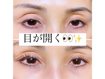 バンビちゃんのお目目 熊本店/目が開く★