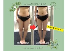 ヨサパーク ハヌル 住吉 錦糸町(YOSA PARK Haneul)/ルルオン3週間でサイズダウン