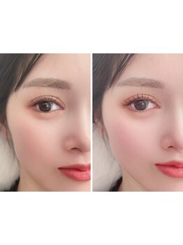 まつげのお悩み解決サロン