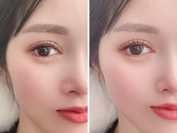 ウィンク 勝どき(wink)の写真/ケラチンTrでダメージを最小限に◎当店拘りのアイテムでまつ毛の修復改善!傷んだまつ毛や逆さまつ毛にも♪