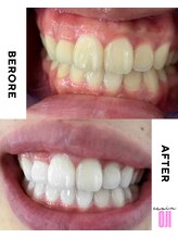 エクシアホワイトニング 王寺店/