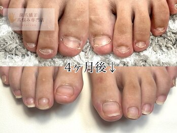 グレースレディ 大阪店/(深爪/長さだし/フィルイン)