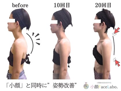 小顔フェイスラボ 西尾店(小顔 Face Labo.)の写真
