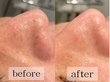 グランビューティ(Glanz Beauty)/30代男性