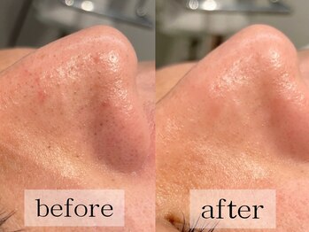 グランビューティ(Glanz Beauty)/30代男性