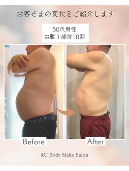 アンドユー(&U)/