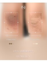 フリュール(FLEUR)/ルメラメラニンケア♪黒ずみ◎