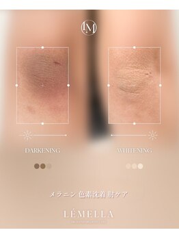 フリュール(FLEUR)/ルメラメラニンケア♪黒ずみ◎