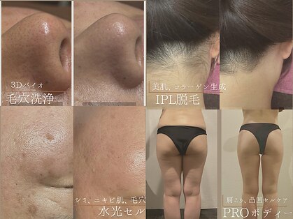 肌屋(HADA-YA)の写真