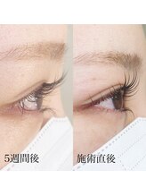 リア 自由が丘(REA)/まつげパーマ（ラッシュリフト）