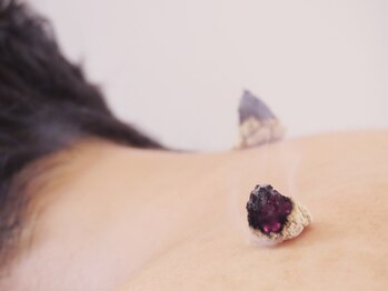 晴レヤカ鍼灸治療院/冷え性・女性のお悩みに