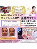 【インスタ見た！リフトアップクーポン】首&顎下のみ　¥8800