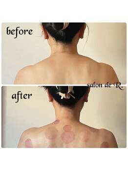 サロン ド アール(salon de R.)/【お背中骨氣・50代・施術効果】