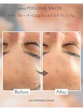 トイロ(toiro)/炭酸パック