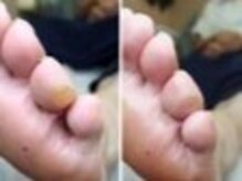 リゼラアンドコー 船橋店/ドイツ式フットケア専門店