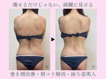 プラスワンビューティテン 新大阪店(Plus One Beauty)の雰囲気（痩身施術効果：ダイエット/脂肪燃焼/疲労回復/むくみ/引き締め）