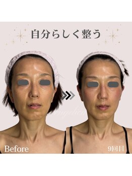 アンジェリカ(Angelica)/本来持つポテンシャルを引き出す