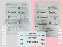 ウェルポート(WELLPORT)/自律神経測定器で状態を可視化