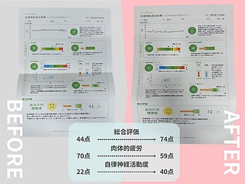 ウェルポート(WELLPORT)/自律神経測定器で状態を可視化