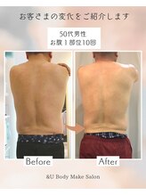 アンドユー(&U)/