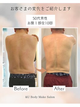 アンドユー(&U)/