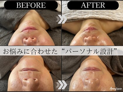 アングレイス(Anngrace)の写真