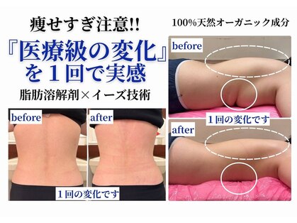 イーズ ミュゼ 梅田本店の写真