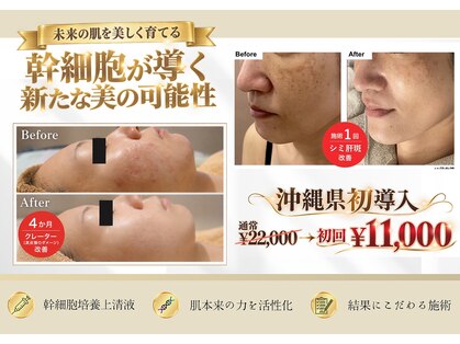 シン(Shin)の写真
