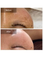 シファ(SHIFA)/シミ・くすみ・ニキビケア