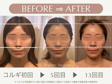 アイミーボーテ(Aime beaute)