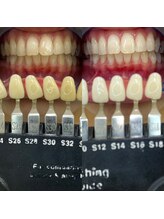 トウキョウスワーズ 池袋店(TOKYO SWRS)/#ホワイトニング #池袋 #渋谷