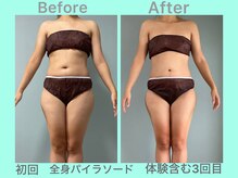 ビーナイス ビューティー(Be Nice Beauty)/停滞期からの脱却 ▲1kg！！