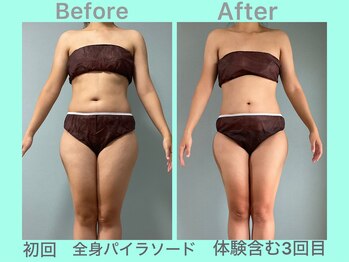 ビーナイス ビューティー(Be Nice Beauty)/停滞期からの脱却 ▲1kg！！