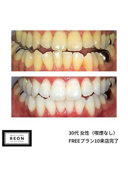 レオン 磐田(REON)/◇ お客様 before＆after ◇