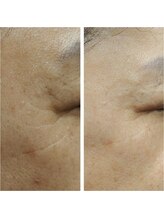 ウェリナベル(WelinaBelle)/ララピール