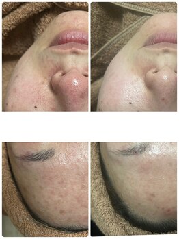 リノ(Lino)/オーダーメイド