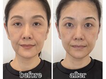 クロア ナゴヤ(Croire NAGOYA)の雰囲気（小顔矯正/光フェイシャル同時施術★目元パッチリ/口元スッキリ）