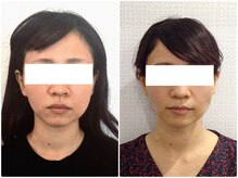 美容整体 ウェリナ 蟹江院/小顔矯正/骨盤矯正/美脚サロン