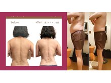 インディバならではのトリートメントで、効果を実感☆