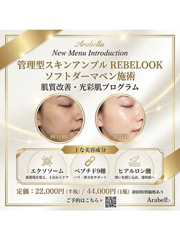 アラベラ(AraBella)の写真/［韓国★最新美容］PDRN×エクソソーム肌育ノンニードル／しっとりとした明るいお肌／毛穴までもっちり