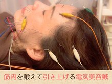健美庵の雰囲気（【電気美容鍼】年齢たるみを鍼に電気を通して筋肉で引き上げる。）