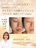 【ハリ艶肌になれる】フェイシャルスクール講師施術ダクトピールフェイシャル