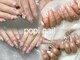 ポピネイル アカバネテン(popi nail)の写真