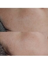 ヴェルシック(Belchic)/トーンを上げて毛穴も目立たなく