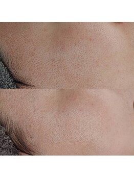 ヴェルシック(Belchic)/トーンを上げて毛穴も目立たなく