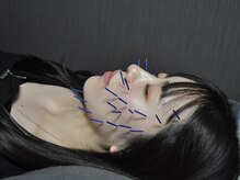 ミレ(mirae)